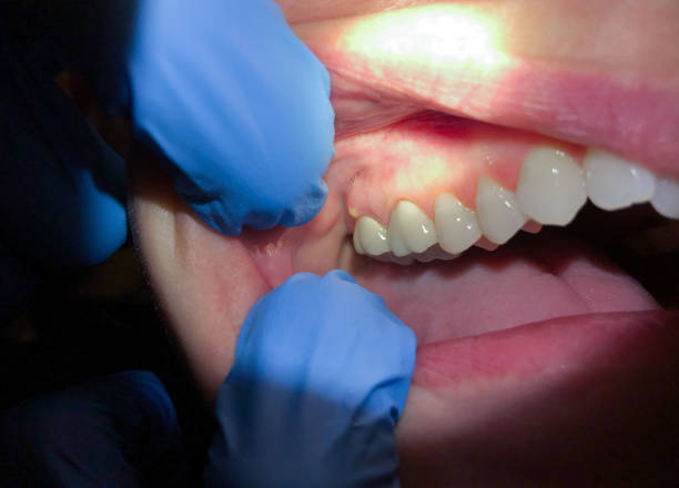 Best Weekend Emergency Dentist in Clever, MO